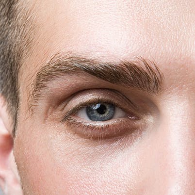 Men with BlephEx | Centers for dry eye